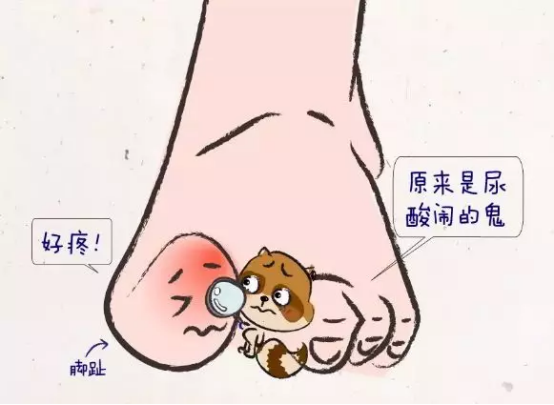 年輕人患痛風怎麽辦
